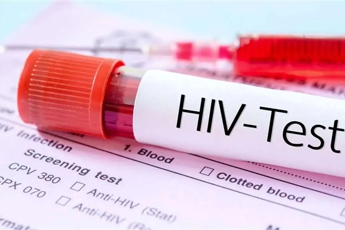 وزارت بهداشت: ۱۱ میلیون نفر در دنیا مبتلا به HIV هستند/ اگر بتوانیم میزان بیماریابی در ایران را به ۸۰ درصد برسانیم، خیال ما در ارتباط با این بیماری راحت شده